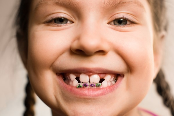 What Happens During Phase   Orthodontics?