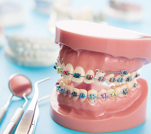 Be Vigilant With Dental Care While Wearing Braces - Henry